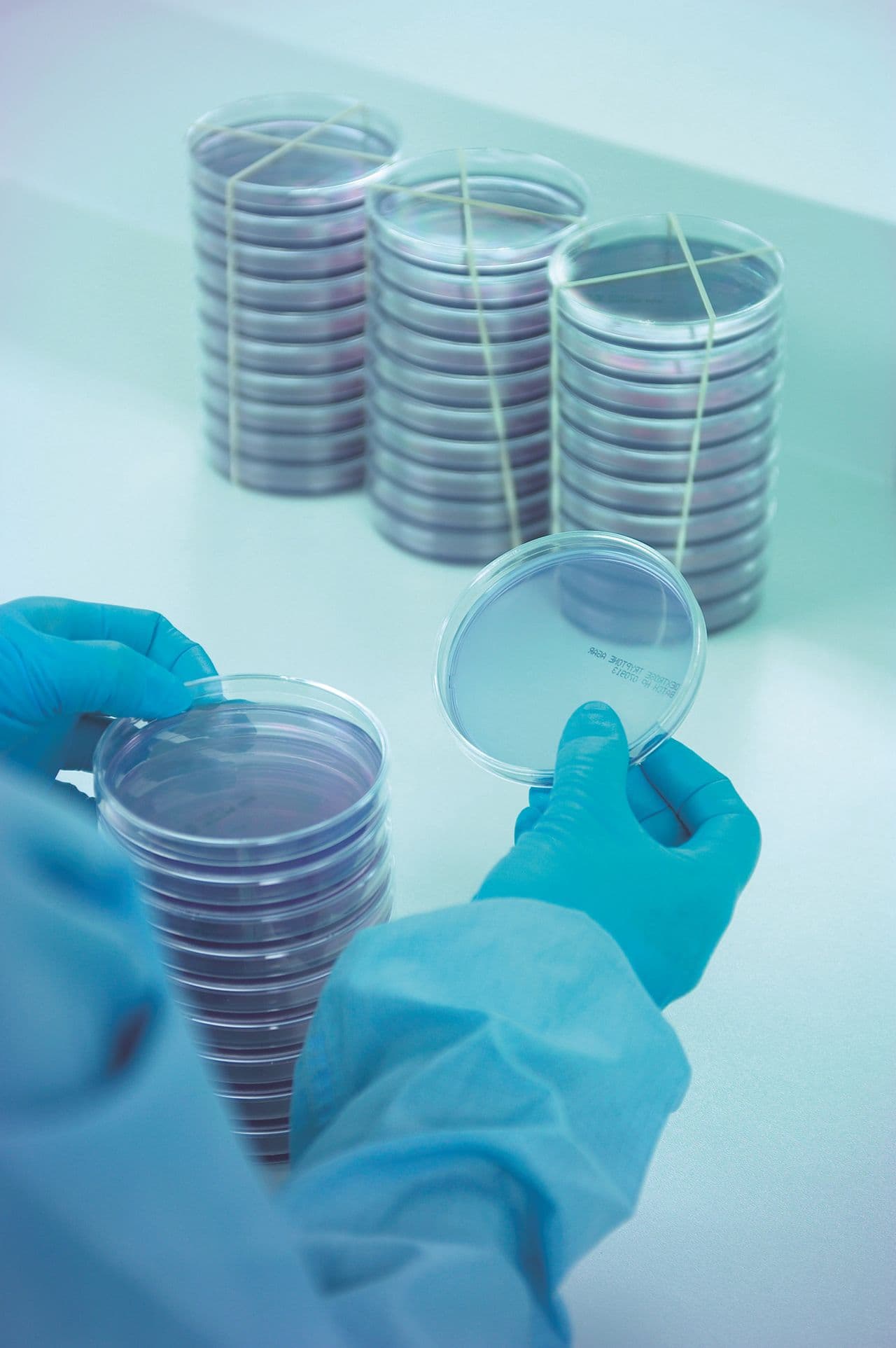 Figure 3: Agar settle plate checking.