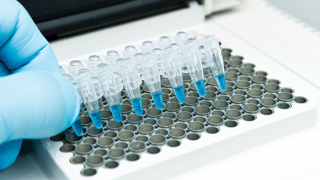 A researcher put a strip of 8 PCR tubes on the thermal cycler for DNA amplification | Image Credit: © HYUNGKEUN - © HYUNGKEUN/Stock.Adobe.com