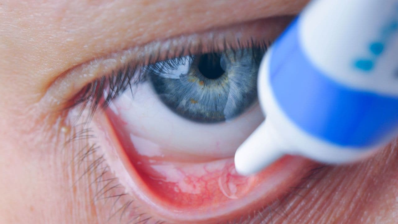 Aiming for Improved Efficacy and Patient Compliance for Topical Ophthalmics