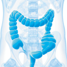 Mission Possible: Targeting Drugs to the Colon